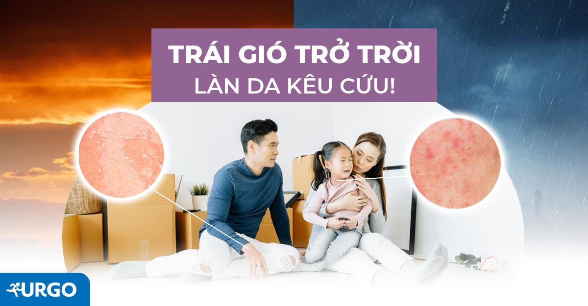 Giải pháp làm dịu sự khó chịu của làn da khi bị viêm da cơ địa - Ảnh 1.