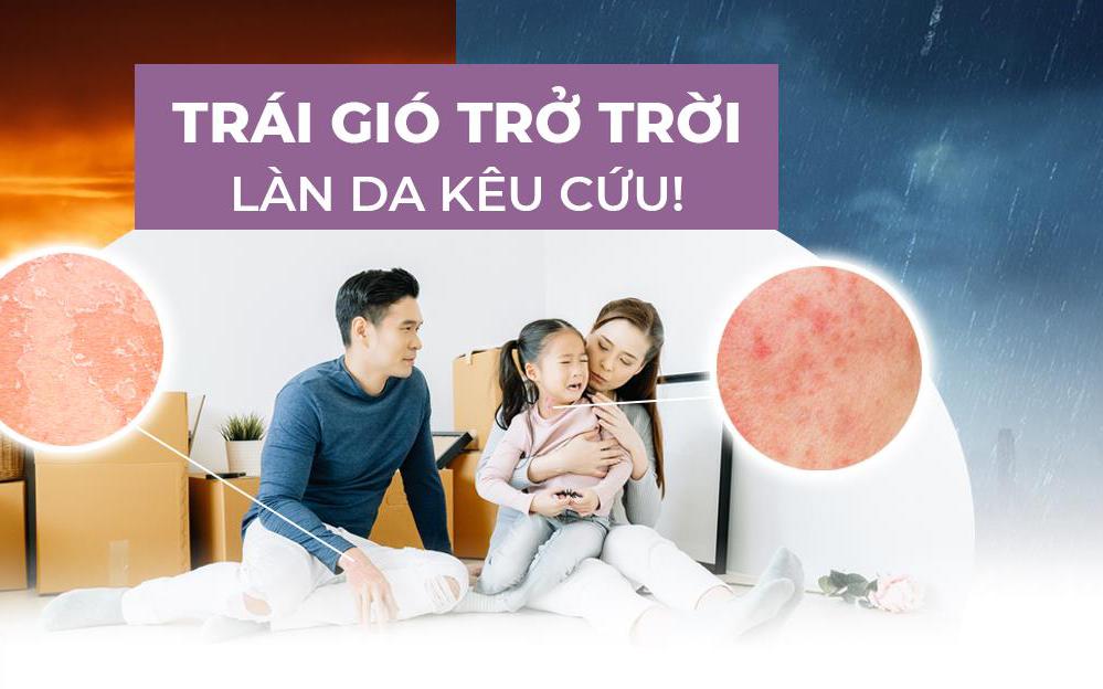 Giải pháp làm dịu sự khó chịu của làn da khi bị viêm da cơ địa