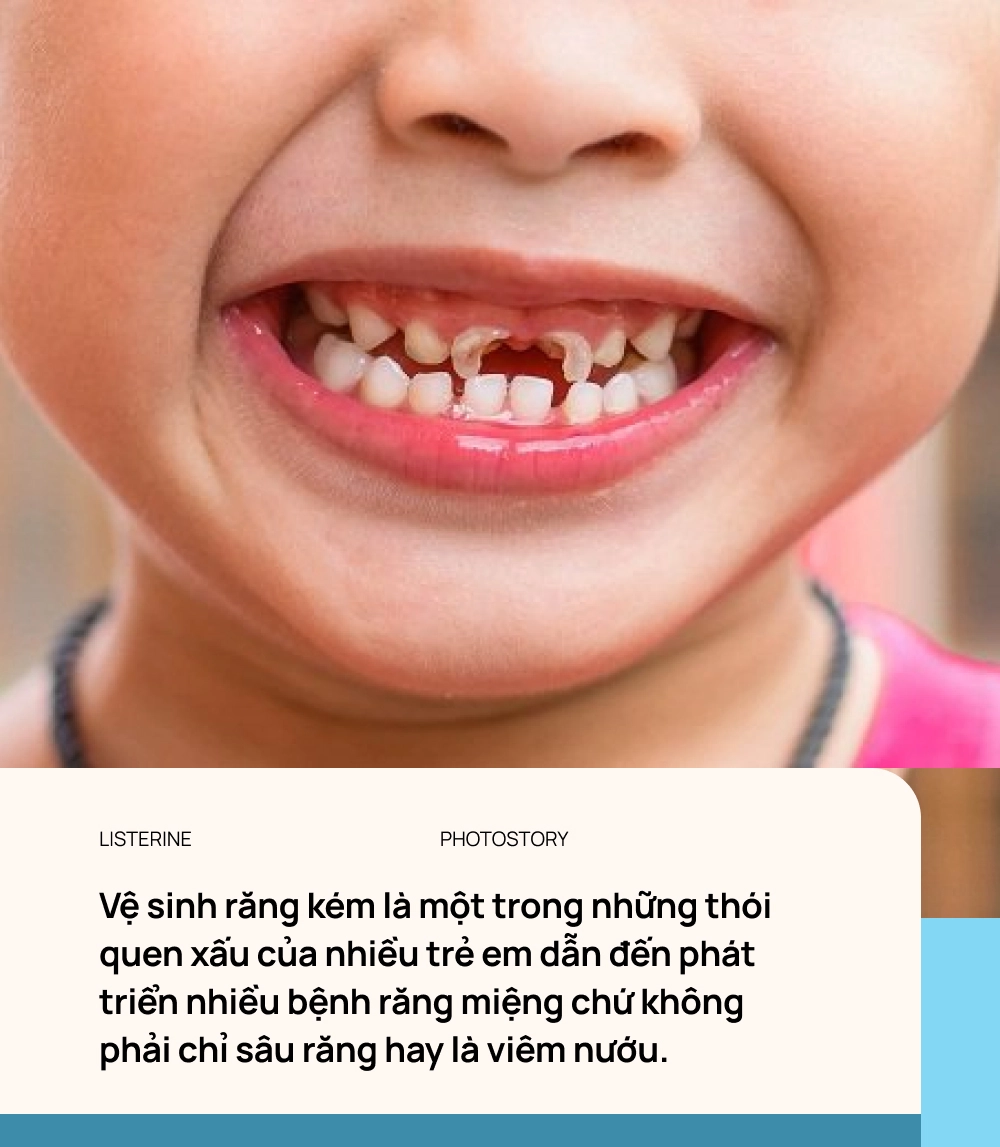 5 sai lầm hàng ngày của cha mẹ và con cái khiến trẻ có nguy cơ hỏng răng từ nhỏ - Ảnh 1.