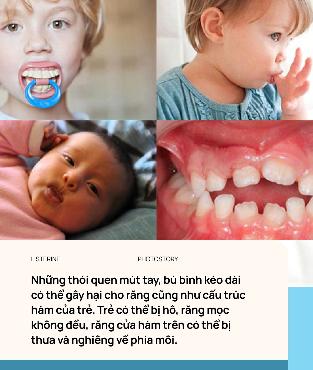 5 sai lầm hàng ngày của cha mẹ và con cái khiến trẻ có nguy cơ hỏng răng từ nhỏ - Ảnh 6.