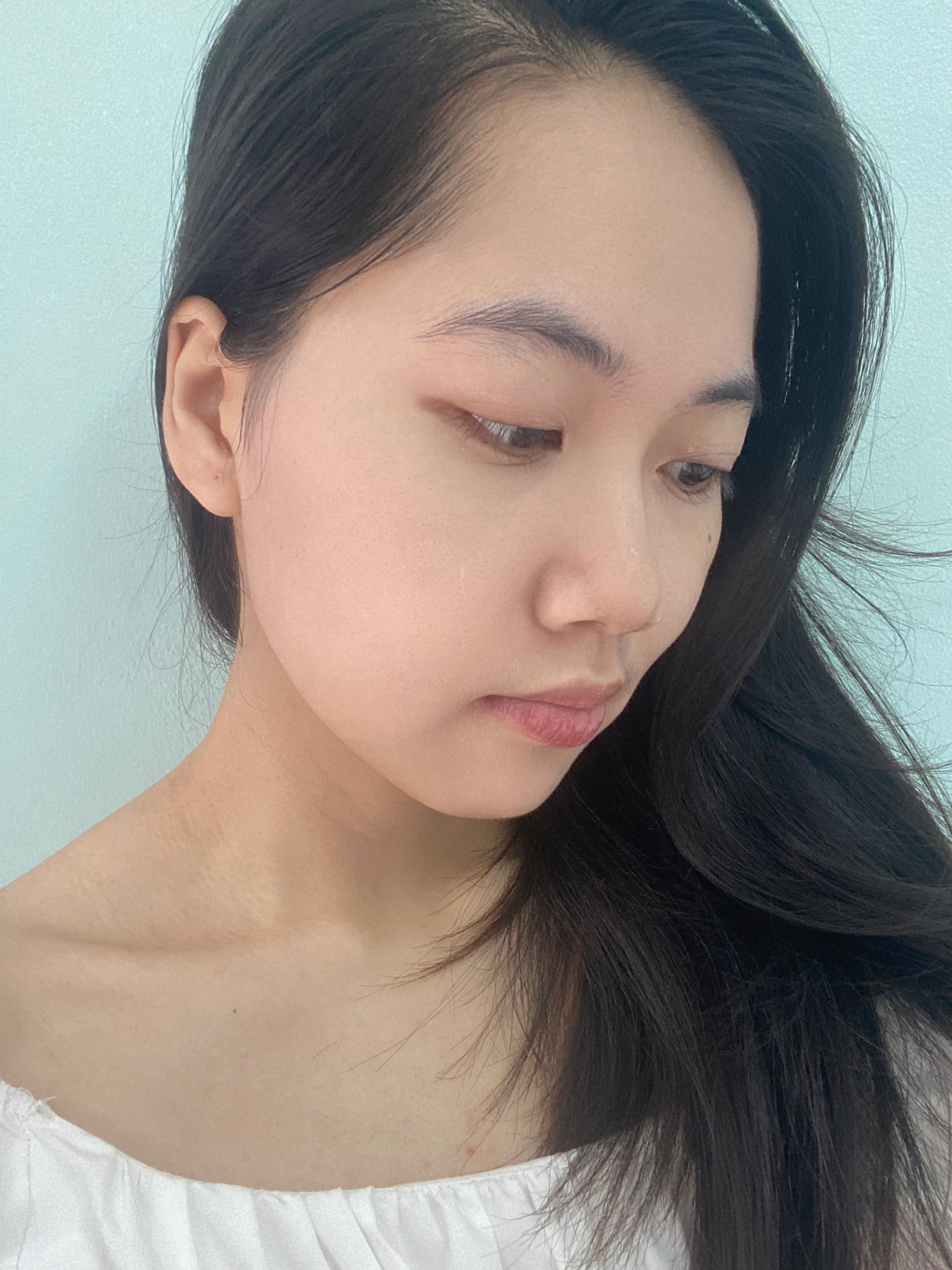 Cách &quot;giải cứu&quot; làn da bị cháy nắng, mẩn đỏ sau khi đi nắng - Ảnh 9.