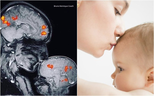 Đừng nghĩ "Trẻ con thì biết gì!", hình ảnh chụp cộng hưởng từ MRI dưới đây khiến bạn thay đổi suy nghĩ