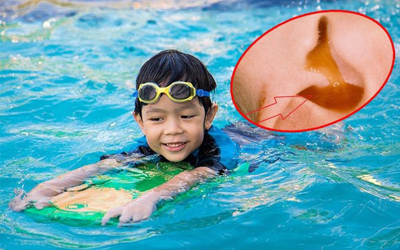 Đây là lý do vì sao trẻ đi bơi thường mắc viêm tai giữa: Cha mẹ cẩn trọng để chặn đứng nguy cơ mắc bệnh cho con