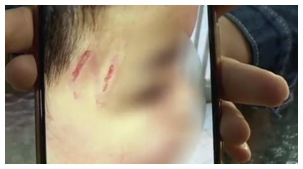 Cậu bé tiểu học bị bạn đánh tới chấn thương nghiêm trọng, ông bố dẫn con tới trường rồi tuyên bố một câu gây tranh cãi - Ảnh 2.