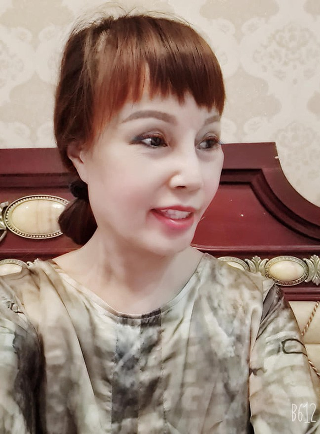 Cô dâu 63 tuổi than thở vì phải nhập viện trị méo miệng do di chứng sau phẫu thuật thẩm mỹ: "Bác sĩ nói để lâu là méo cả đời" - Ảnh 1.