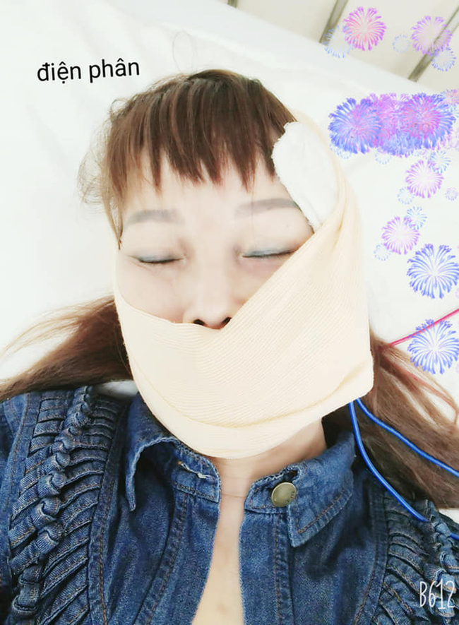 Cô dâu 63 tuổi than thở vì phải nhập viện trị méo miệng do di chứng sau phẫu thuật thẩm mỹ: "Bác sĩ nói để lâu là méo cả đời" - Ảnh 3.