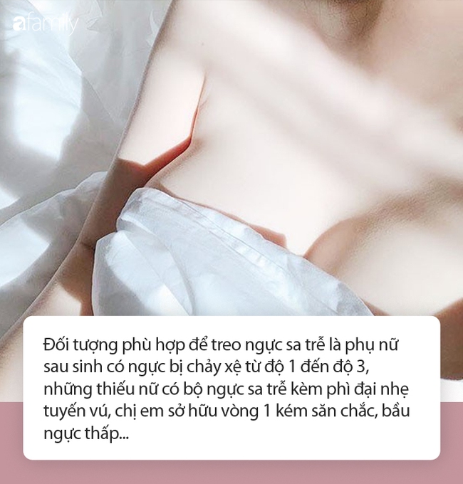 Treo ngực sa trễ: Chuyên gia tiết lộ từ A đến Z, đáng lưu tâm nhất là phẫu thuật có để lại sẹo hay không - Ảnh 4.