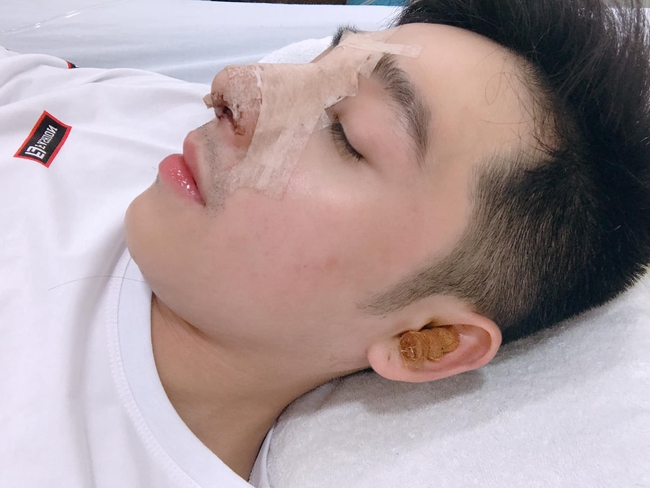 Liều lĩnh PTTM 4 lần trong 8 tháng vì thất tình, chàng trai Kiên Giang lột xác ngoạn mục nhưng có trải nghiệm rùng mình khiến ai có ý định cần cân nhắc - Ảnh 5.