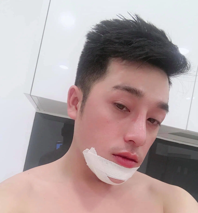 Liều lĩnh PTTM 4 lần trong 8 tháng vì thất tình, chàng trai Kiên Giang lột xác ngoạn mục nhưng có trải nghiệm rùng mình khiến ai có ý định cần cân nhắc - Ảnh 4.
