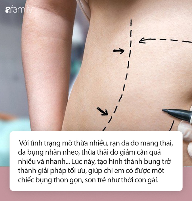 Tạo hình thành bụng: Chuyên gia đầu ngành chia sẻ từ quy trình đến lưu ý cần nhớ trước khi làm - Ảnh 1.