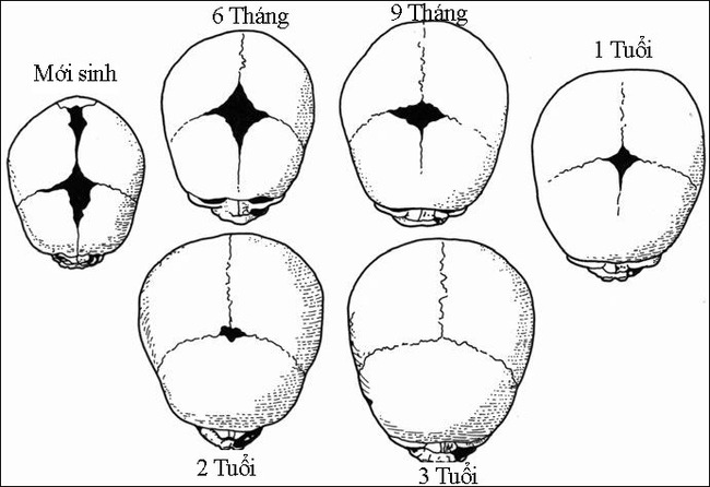 Nhìn thóp của em bé mềm và mỏng manh như thế, ai ngờ được đó lại là yếu tố để theo dõi sức khỏe của trẻ sơ sinh - Ảnh 2.