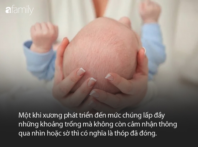 Không chỉ có 1 mà trẻ sơ sinh có đến 6 thóp trên đầu, nhưng bố mẹ chỉ cần lưu ý 2 điểm  - Ảnh 4.