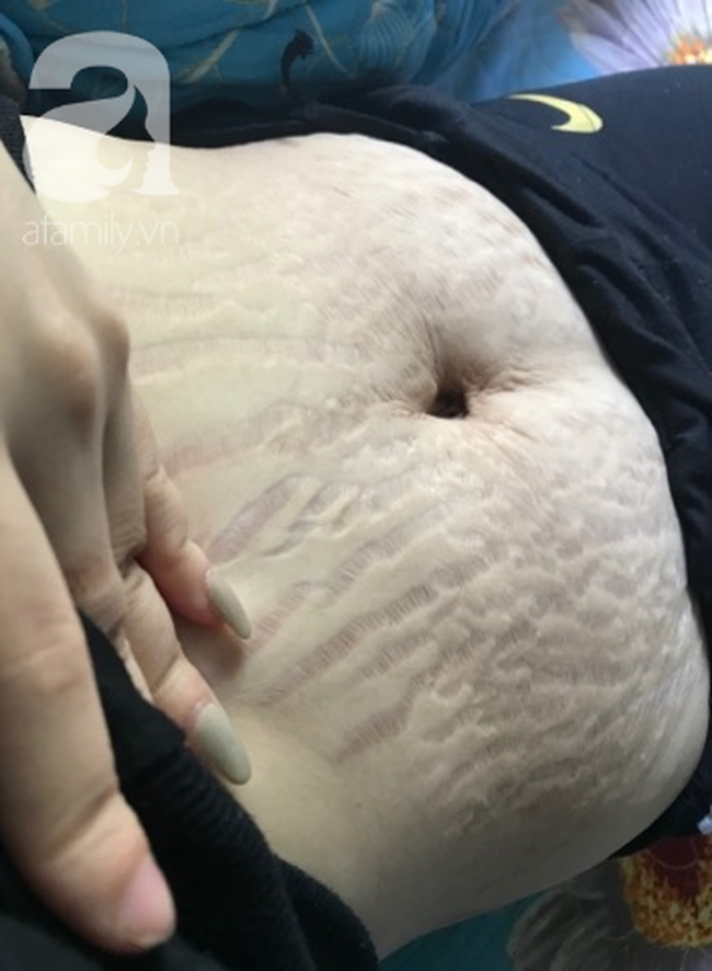 Mẹ 9X tâm sự bụng rạn tan nát, "đánh đổi cả thanh xuân vì con", các mẹ khác chua xót thở dài đồng cảnh ngộ - Ảnh 6.