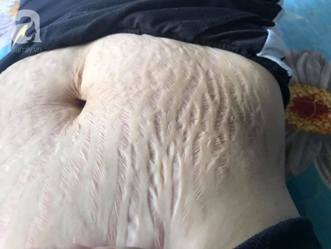 Mẹ 9X tâm sự bụng rạn tan nát, "đánh đổi cả thanh xuân vì con", các mẹ khác chua xót thở dài đồng cảnh ngộ - Ảnh 5.