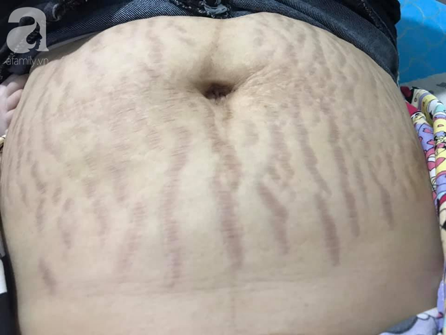 Mẹ 9X tâm sự bụng rạn tan nát, "đánh đổi cả thanh xuân vì con", các mẹ khác chua xót thở dài đồng cảnh ngộ - Ảnh 2.