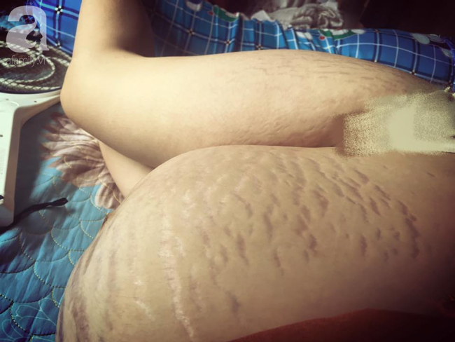 Mẹ 9X tâm sự bụng rạn tan nát, "đánh đổi cả thanh xuân vì con", các mẹ khác chua xót thở dài đồng cảnh ngộ - Ảnh 1.