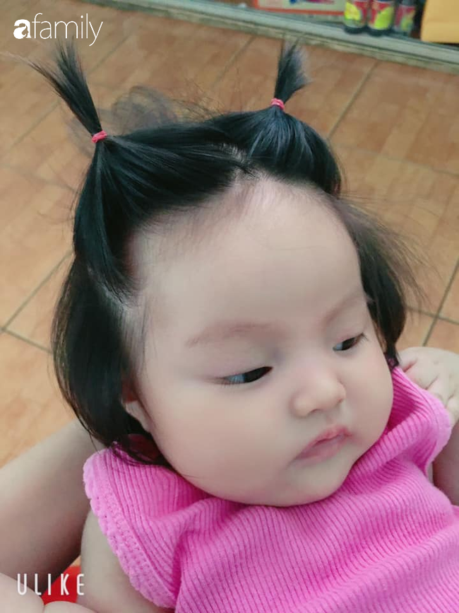 Bé gái 3 tháng tuổi gây sốt vì mái tóc "chôm chôm" dài, đen, dựng đứng, vừa chào đời đã gây ấn tượng nhất khoa sản - Ảnh 3.