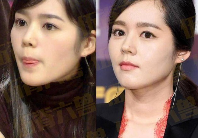 6. Han Ga In: Sau khi kết hôn năm 2005, Han Ga In không còn đóng phim quá nhiều nhưng cô vẫn luôn là nữ diễn viên hàng đầu của Kbiz. Gương mặt xinh đẹp cùng sống mũi cao mà nhiều người mơ ước, Han Ga In sau nhiều năm vẫn đẹp như những ngày đầu mới bước chân vào showbiz.
