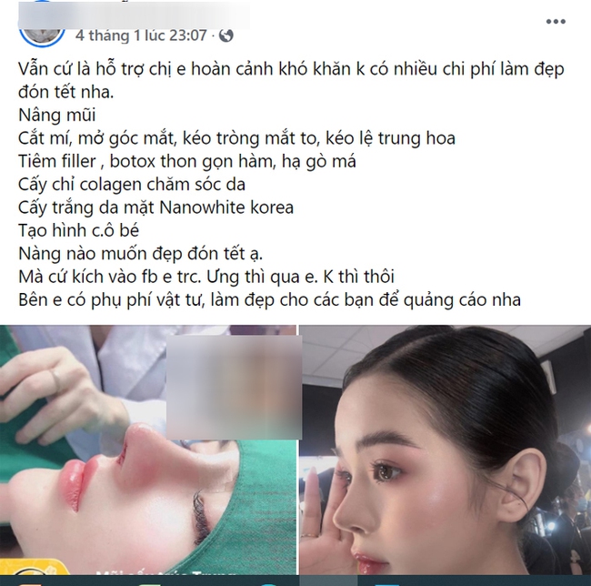 Mê tiêm filler tại spa rẻ tiền, chị em gặp biến chứng kinh hoàng và lời cảnh báo gan ruột từ chuyên gia - Ảnh 2.