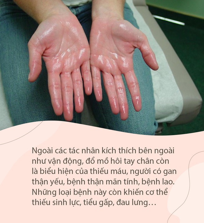 Đổ mồ hôi là điều bình thường, nhưng nếu xuất hiện ở những nơi này, chứng tỏ sức khỏe có vấn đề, 1 vị trí là dấu hiệu của đột quỵ  - Ảnh 1.