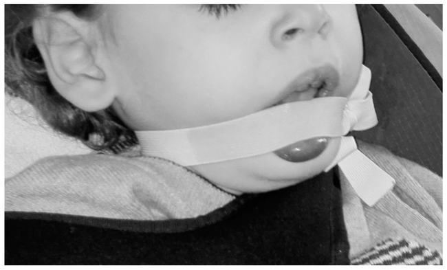 Bí ẩn căn bệnh "tự ăn thịt chính mình" gây kinh hãi đến ngày nay vẫn chưa được giải mã, đáng sợ nhất là đối tượng mắc bệnh chỉ toàn trẻ nhỏ - Ảnh 2.