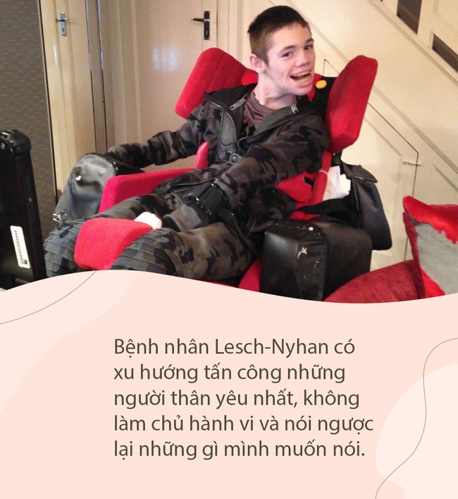 Bí ẩn căn bệnh "tự ăn thịt chính mình" gây kinh hãi đến ngày nay vẫn chưa được giải mã, đáng sợ nhất là đối tượng mắc bệnh chỉ toàn trẻ nhỏ - Ảnh 4.