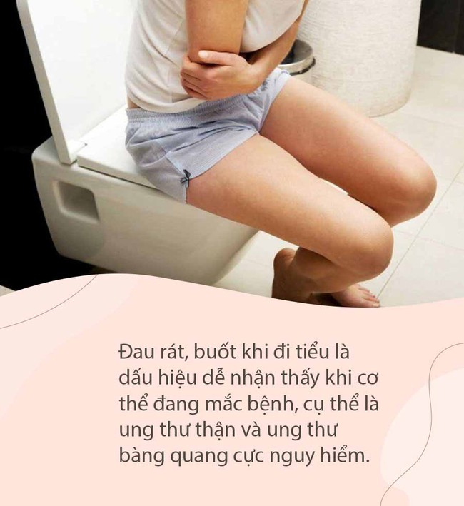 Đi tiểu mà thấy 4 bất thường này coi chừng ung thư đang "gieo mầm" trong cơ thể: Dấu hiệu số 2 ai cũng từng mắc phải mà không biết - Ảnh 4.