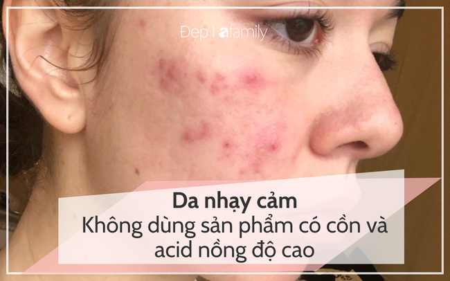 Nắm được những điều này, bạn sẽ không còn phải tốn quá nhiều tiền cho mỹ phẩm skin care - Ảnh 5.