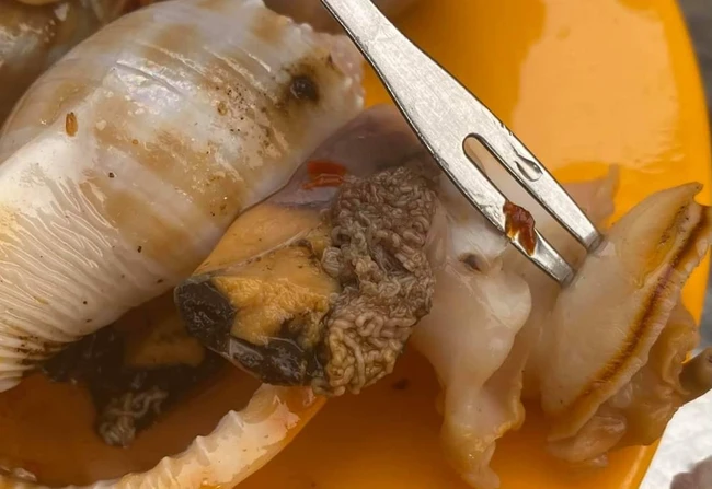 Đang hí hửng khêu con ốc ra ăn, thanh niên hoảng hốt phát hiện nguyên một bầy giun sán bám ngay trên mặt thịt ốc - Ảnh 2.