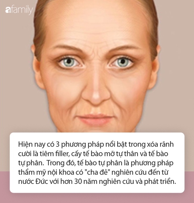 Ngoài tiêm filler và tế bào tự thân, chuyên gia "bật mí" phương pháp có ưu điểm vượt trội, hiệu quả kéo dài hàng chục năm - Ảnh 2.