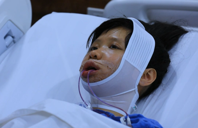26 năm sống trong hình hài "Thị Nở", cô gái Quảng Ninh lột xác xinh đẹp như hoa hậu nhờ 3 lần thẩm mỹ và khoảnh khắc tái ngộ em gái sinh đôi gây xúc động - Ảnh 3.