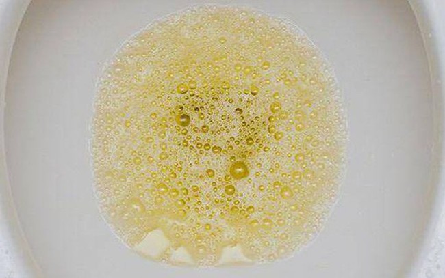 Phát hiện thay đổi rõ ràng ở 4 bộ phận này trên cơ thể, nên đi kiểm tra thận gấp - Ảnh 4.