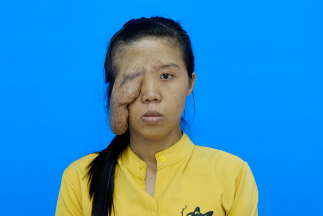 Mẹ đơn thân có biệt danh "một mắt" và 3 cuộc đại phẫu thay đổi cuộc đời, phản ứng khi con gái gặp lại mẹ tuy bẽ bàng nhưng ai cũng phải rớt nước mắt - Ảnh 2.