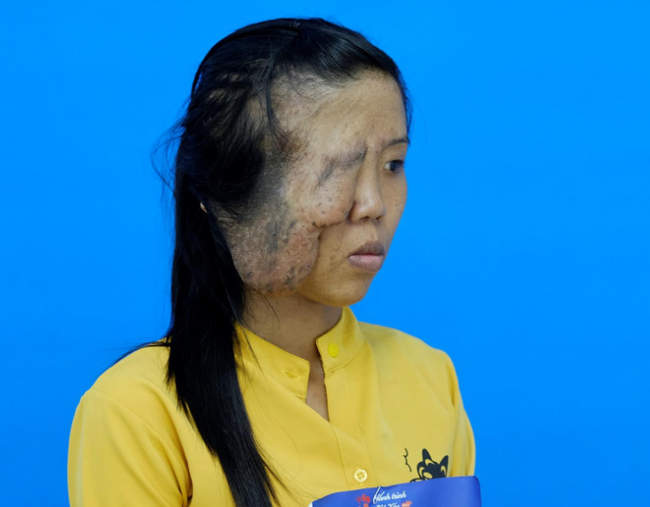 Mẹ đơn thân có biệt danh "một mắt" và 3 cuộc đại phẫu thay đổi cuộc đời, phản ứng khi con gái gặp lại mẹ tuy bẽ bàng nhưng ai cũng phải rớt nước mắt - Ảnh 3.