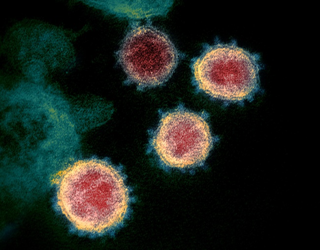 Virus SARS-CoV-2 lây truyền trong không khí: Đứng cách người bị nhiễm 10m vẫn bị lây như thường? - Ảnh 1.