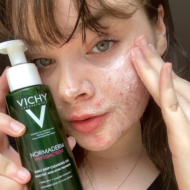 Đeo khẩu trang cả ngày và da hứng chịu đủ thứ mụn, hậu quả của việc bạn chưa biết cách chăm sóc làn da - Ảnh 2.