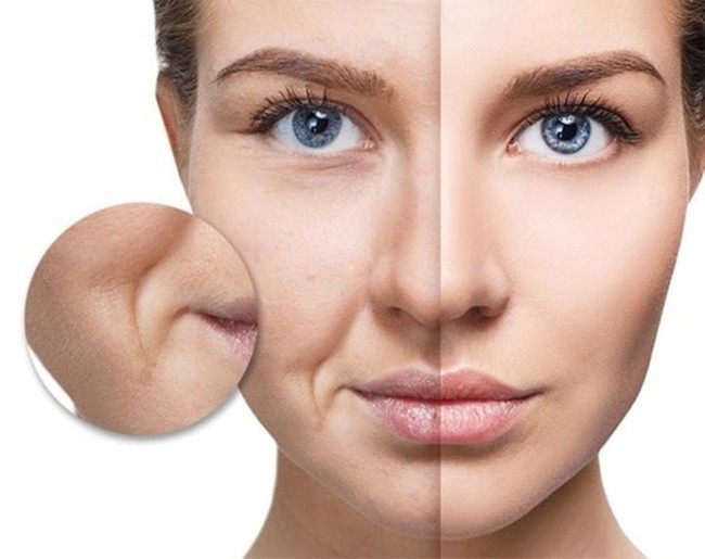 Có một "bí mật bệnh tật" ẩn trong nếp nhăn, ai cũng cần biết để phòng tránh - Ảnh 4.