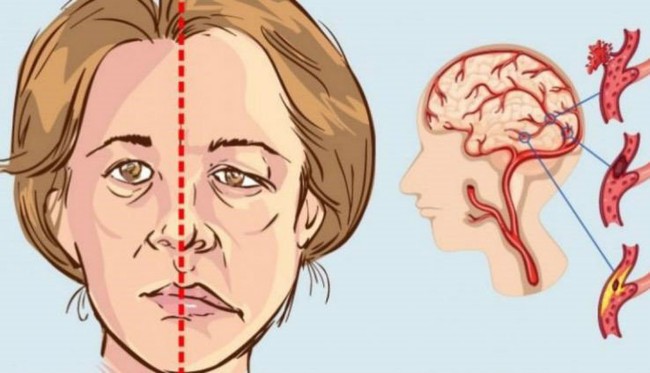 Đây là căn bệnh cần điều trị dự phòng, đừng để bị rồi mới hối thì đã muộn! - Ảnh 4.