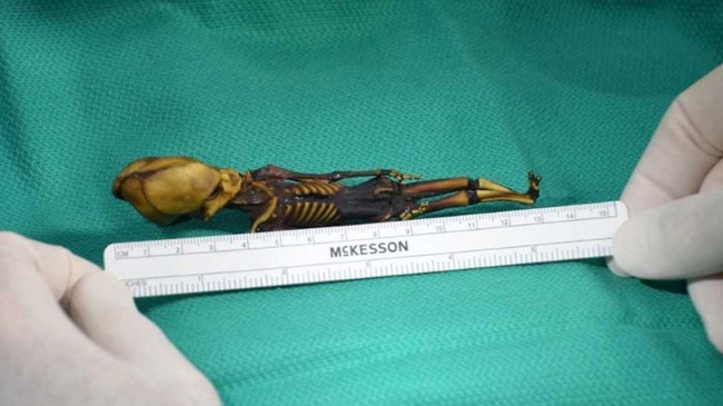 Bí ẩn về xác ướp "ngoài hành tinh" dài 13cm ở sa mạc khô nhất thế giới, sau 18 năm giải mã y học không khỏi đau lòng vì lý do đằng sau - Ảnh 2.