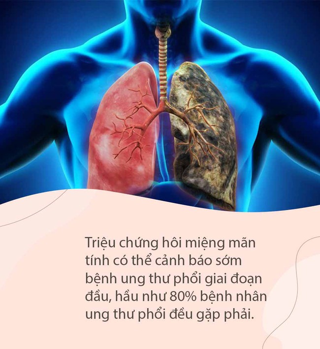 Khi hơi thở vẫn bốc 5 kiểu mùi này dù đã vệ sinh sạch sẽ, coi chừng bạn đang mắc nhiều loại bệnh: Hãy tự kiểm tra ngay vì có cả ung thư - Ảnh 5.