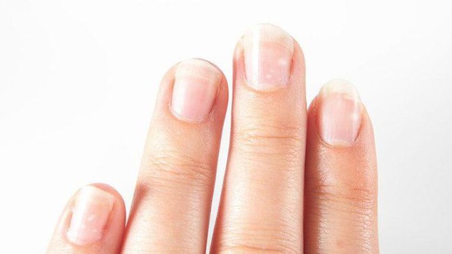 Người tuổi thọ ngắn, 4 vị trí này trên cơ thể sẽ chuyển màu trắng, biết sớm kịp thời chữa trị - Ảnh 2.