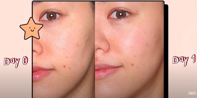 3 sản phẩm chống già cực đỉnh được Elle Korea bình chọn - Ảnh 8.