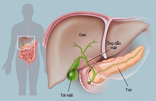 BS chuyên khoa cảnh báo 5 loại ung thư nguy hiểm cần thận trọng - Ảnh 2.