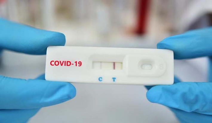 Test Covid nhanh hiện 2 vạch nhưng xét nghiệm PCR lại âm tính: BS chỉ rõ 3 lý do, lưu ý một điều sống còn dù đã, đang dương tính hay chưa bao giờ bị Covid-19 - Ảnh 1.